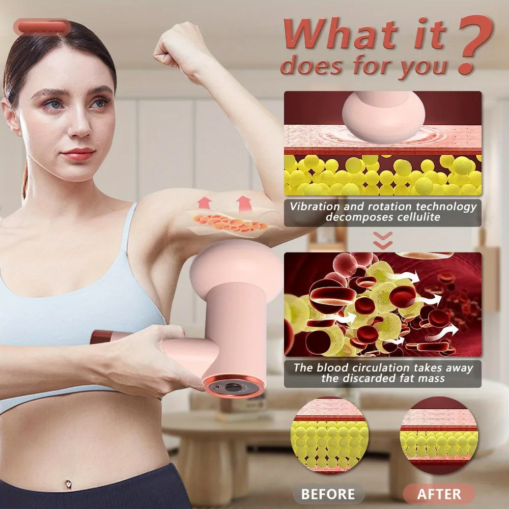 Sb94fd016e76c4619bd2b7587863dd95bP.webp Appareil De Massage Minceur - Modelage Cellulite Du Corps - Soin Anti-Graisse - Perte De Poids – Image 1