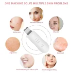 Appareil De Lifting Facial Pour Un Nettoyage En Profondeur Et Une Hydratation Du Visage Par Pulvérisation – Image 6