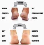 Paire De Chaussettes De Protection Sur Toute La Longueur - Anti-Fissures - Hydratantes - Hommes et Femmes – Image 5