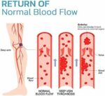 Packs De Deux Genouillère Thérapeutiques Anti-varices À La Tourmaline - Points De Pression - Auto-Chauffantes - Pour Hommes Et Femmes – Image 10