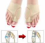 2 Attelle Et Orthèse Correctrices Pour Réduire L'évolution De L'hallux Valgus Et Soulager Les Douleurs Articulaires – Image 4