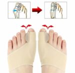 2 Attelle Et Orthèse Correctrices Pour Réduire L'évolution De L'hallux Valgus Et Soulager Les Douleurs Articulaires – Image 5