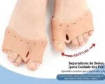 Séparateur D'orteils Pour Soulager La Douleur Des Oignons en Silicone – Image 2